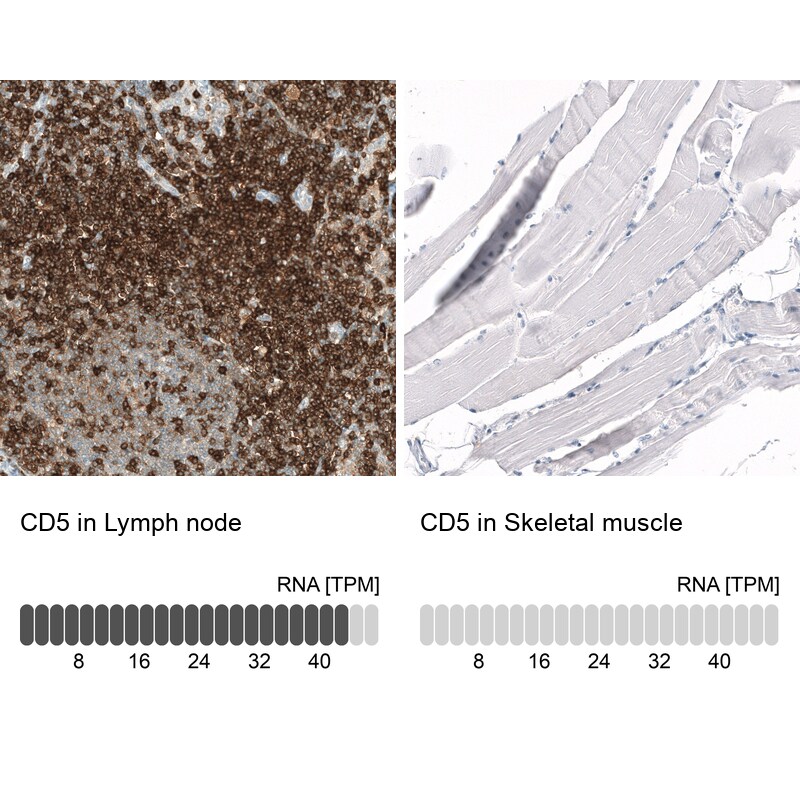 CD5 Antibody (CL12334) - Azide and BSA Free Immunohistochemistry-Paraffin: CD5 Antibody [NBP3-44362]