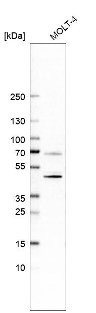 CD5 Antibody (CL12334) - Azide and BSA Free Western Blot: CD5 Antibody [NBP3-44362]