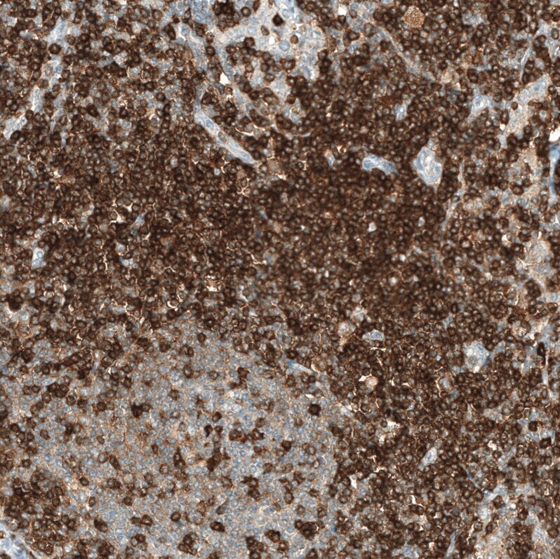 CD5 Antibody (CL12334) - Azide and BSA Free Immunohistochemistry-Paraffin: CD5 Antibody [NBP3-44362]