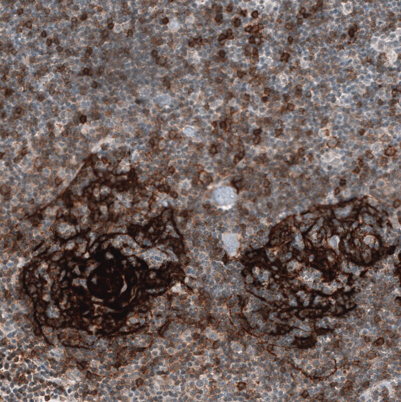 CD23/Fc epsilon RII Antibody (CL12435) - Azide and BSA Free Immunohistochemistry-Paraffin: CD23/Fc epsilon RII Antibody [NBP3-44363]