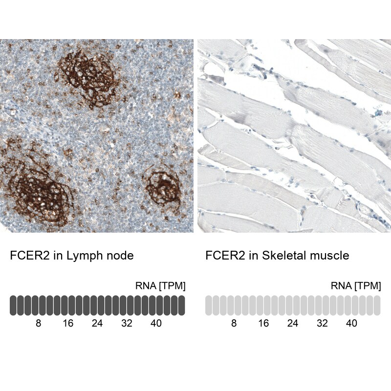 CD23/Fc epsilon RII Antibody (CL12435) - Azide and BSA Free Immunohistochemistry-Paraffin: CD23/Fc epsilon RII Antibody [NBP3-44363]