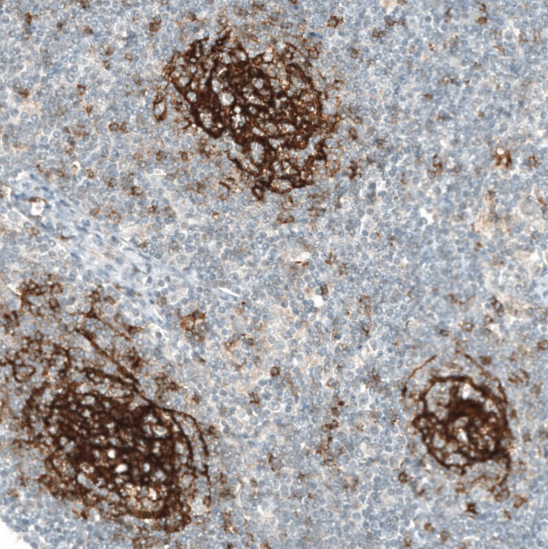 CD23/Fc epsilon RII Antibody (CL12435) - Azide and BSA Free Immunohistochemistry-Paraffin: CD23/Fc epsilon RII Antibody [NBP3-44363]