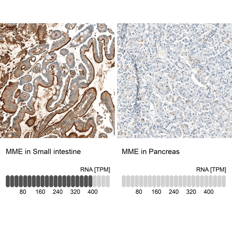Neprilysin/CD10 Antibody (CL12448) - Azide and BSA Free Immunohistochemistry-Paraffin: Neprilysin/CD10 Antibody [NBP3-44364]