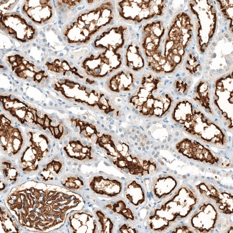 Neprilysin/CD10 Antibody (CL12448) - Azide and BSA Free Immunohistochemistry-Paraffin: Neprilysin/CD10 Antibody [NBP3-44364]