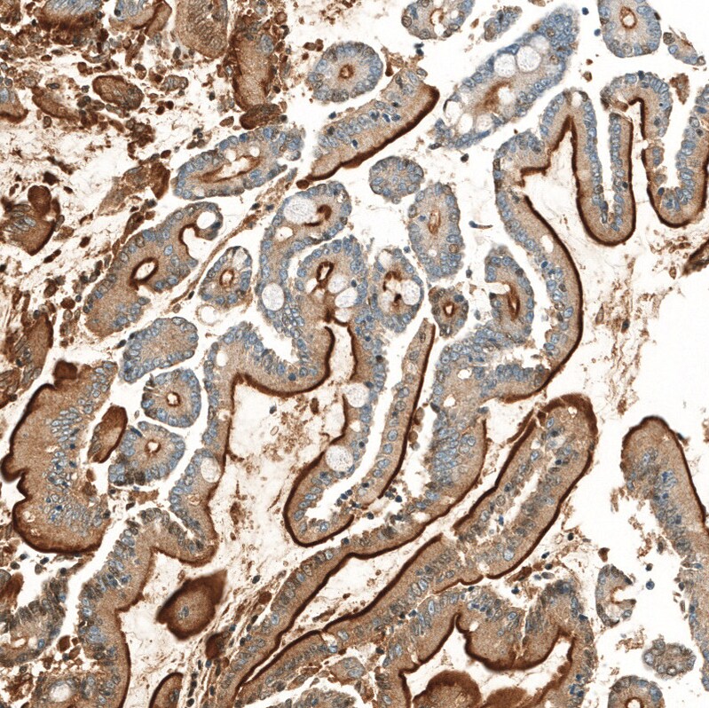 Neprilysin/CD10 Antibody (CL12448) - Azide and BSA Free Immunohistochemistry-Paraffin: Neprilysin/CD10 Antibody [NBP3-44364]