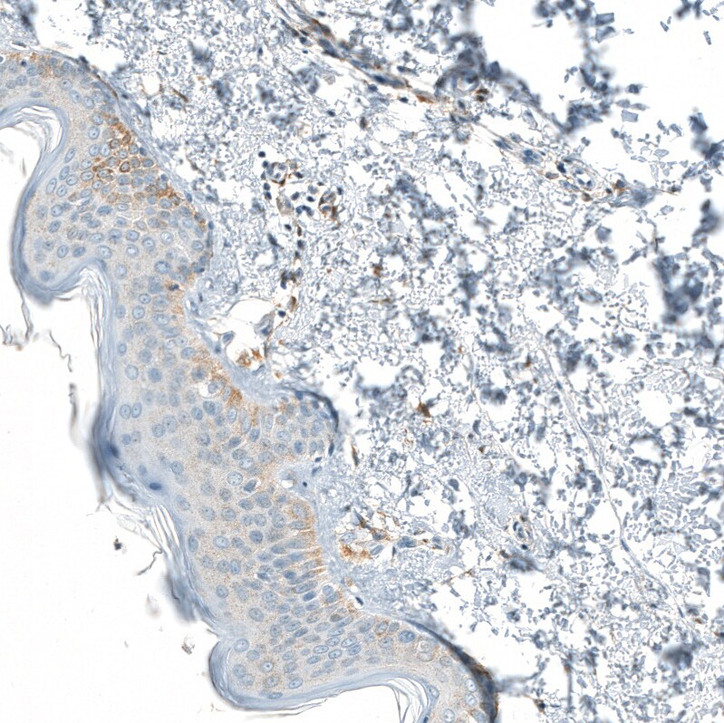 Neprilysin/CD10 Antibody (CL12448) - Azide and BSA Free Immunohistochemistry-Paraffin: Neprilysin/CD10 Antibody [NBP3-44364]