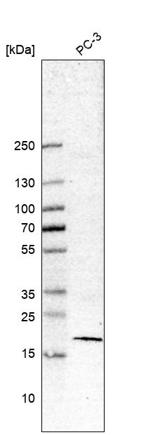 Survivin Antibody (CL12064) - Azide and BSA Free Western Blot: Survivin Antibody [NBP3-44365]