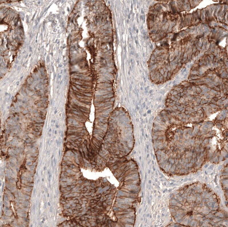 Claudin-3 Antibody (CL13130) - Azide and BSA Free Immunohistochemistry-Paraffin: Claudin-3 Antibody [NBP3-44366]