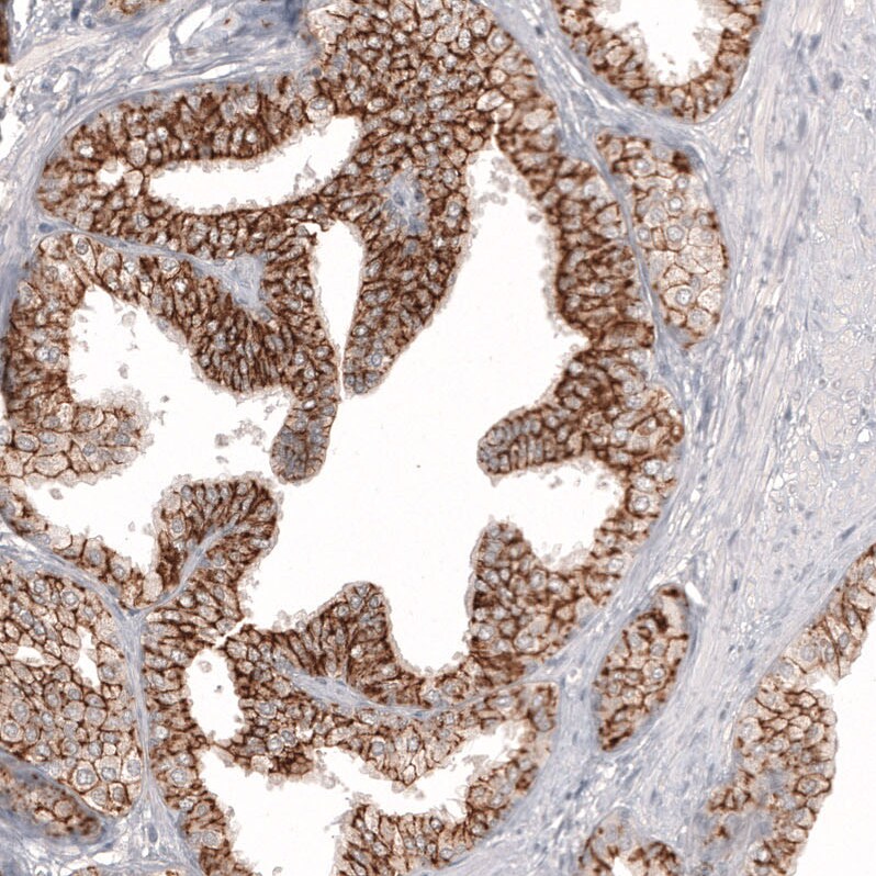 Claudin-3 Antibody (CL13130) - Azide and BSA Free Immunohistochemistry-Paraffin: Claudin-3 Antibody [NBP3-44366]