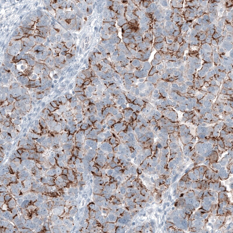 Claudin-3 Antibody (CL13130) - Azide and BSA Free Immunohistochemistry-Paraffin: Claudin-3 Antibody [NBP3-44366]