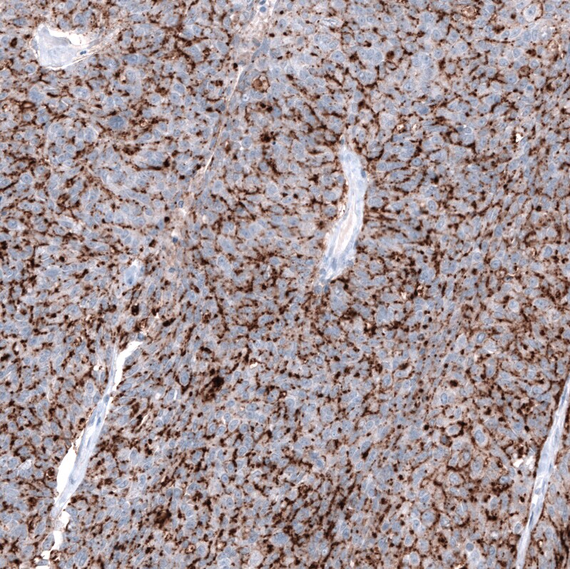 Claudin-3 Antibody (CL13130) - Azide and BSA Free Immunohistochemistry-Paraffin: Claudin-3 Antibody [NBP3-44366]