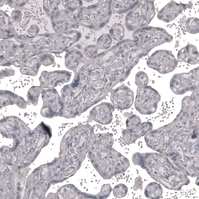 Claudin-3 Antibody (CL13130) - Azide and BSA Free Immunohistochemistry-Paraffin: Claudin-3 Antibody [NBP3-44366]