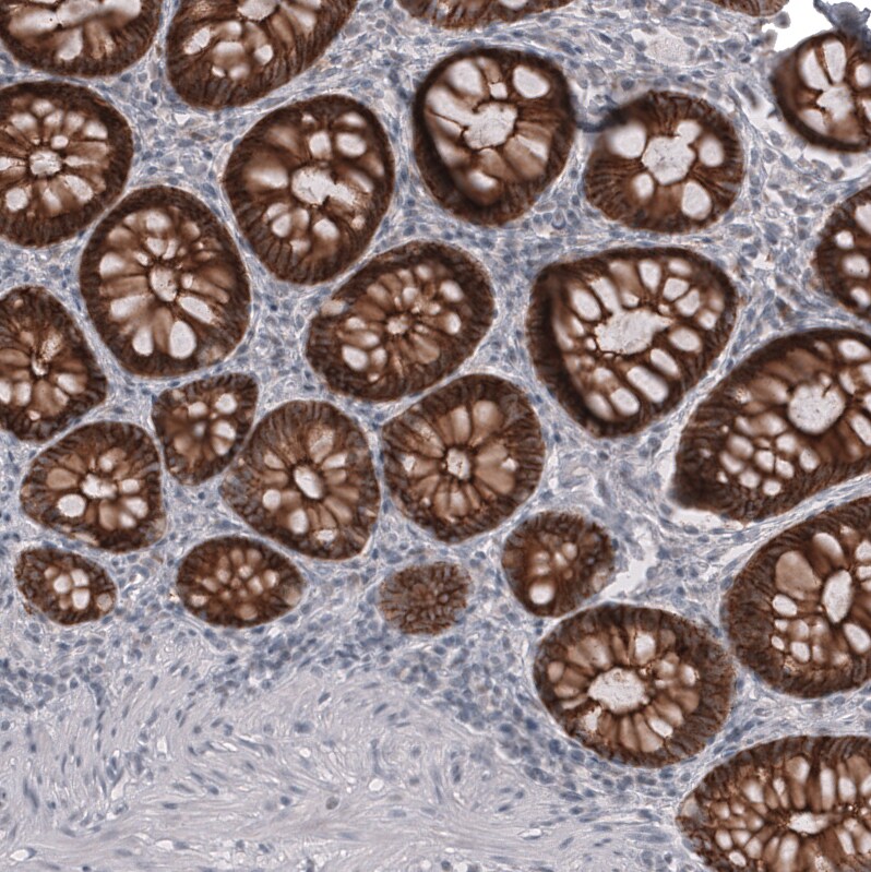 Claudin-3 Antibody (CL13129) - Azide and BSA Free Immunohistochemistry-Paraffin: Claudin-3 Antibody [NBP3-44367]