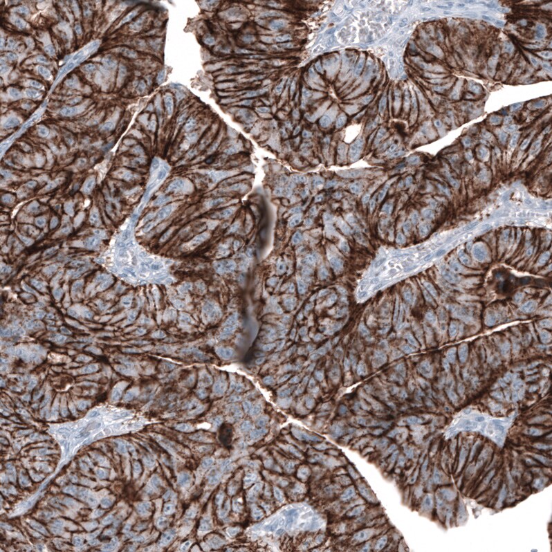 Claudin-3 Antibody (CL13129) - Azide and BSA Free Immunohistochemistry-Paraffin: Claudin-3 Antibody [NBP3-44367]