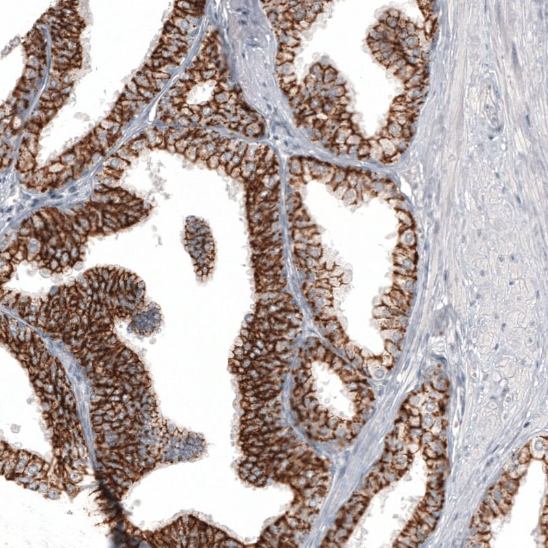 Claudin-3 Antibody (CL13129) - Azide and BSA Free Immunohistochemistry-Paraffin: Claudin-3 Antibody [NBP3-44367]