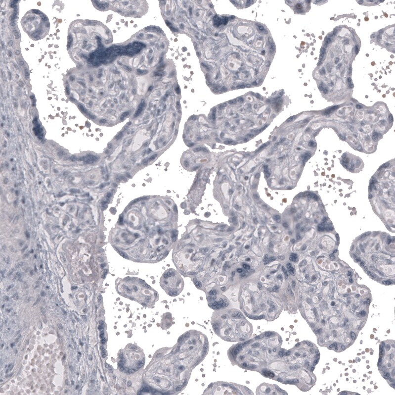 Claudin-3 Antibody (CL13129) - Azide and BSA Free Immunohistochemistry-Paraffin: Claudin-3 Antibody [NBP3-44367]