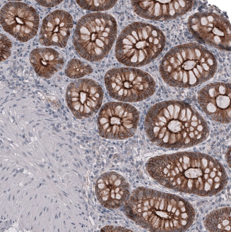 Claudin-3 Antibody (CL13128) - Azide and BSA Free Immunohistochemistry-Paraffin: Claudin-3 Antibody [NBP3-44368]