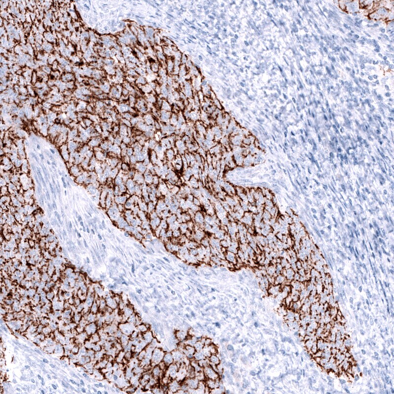 Claudin-3 Antibody (CL13128) - Azide and BSA Free Immunohistochemistry-Paraffin: Claudin-3 Antibody [NBP3-44368]