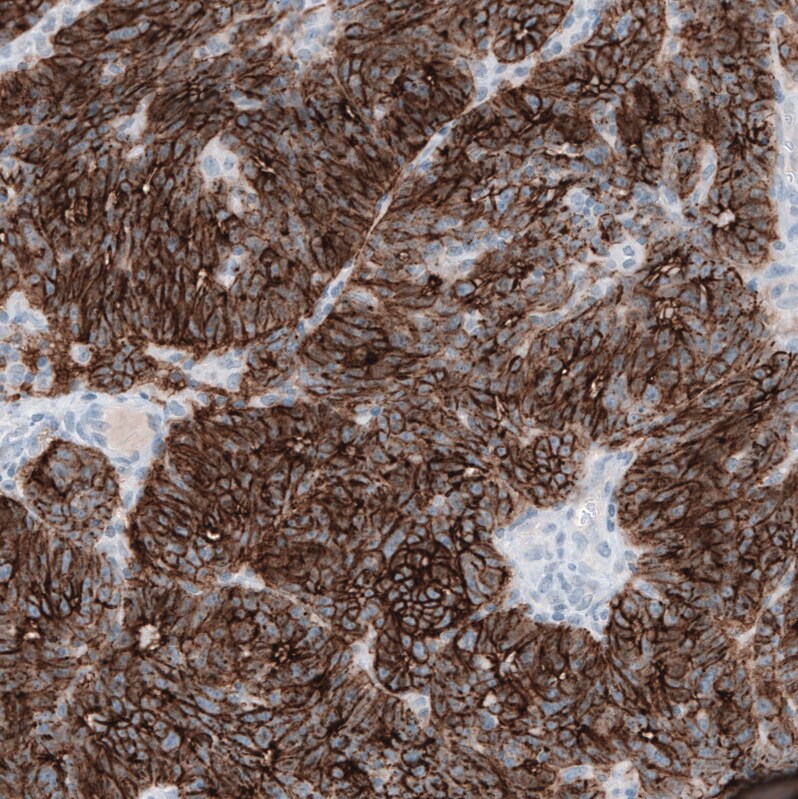 Claudin-3 Antibody (CL13128) - Azide and BSA Free Immunohistochemistry-Paraffin: Claudin-3 Antibody [NBP3-44368]