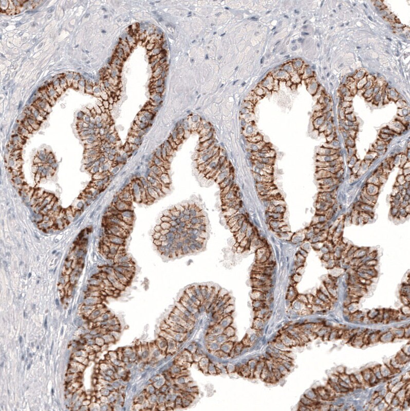 Claudin-3 Antibody (CL13128) - Azide and BSA Free Immunohistochemistry-Paraffin: Claudin-3 Antibody [NBP3-44368]