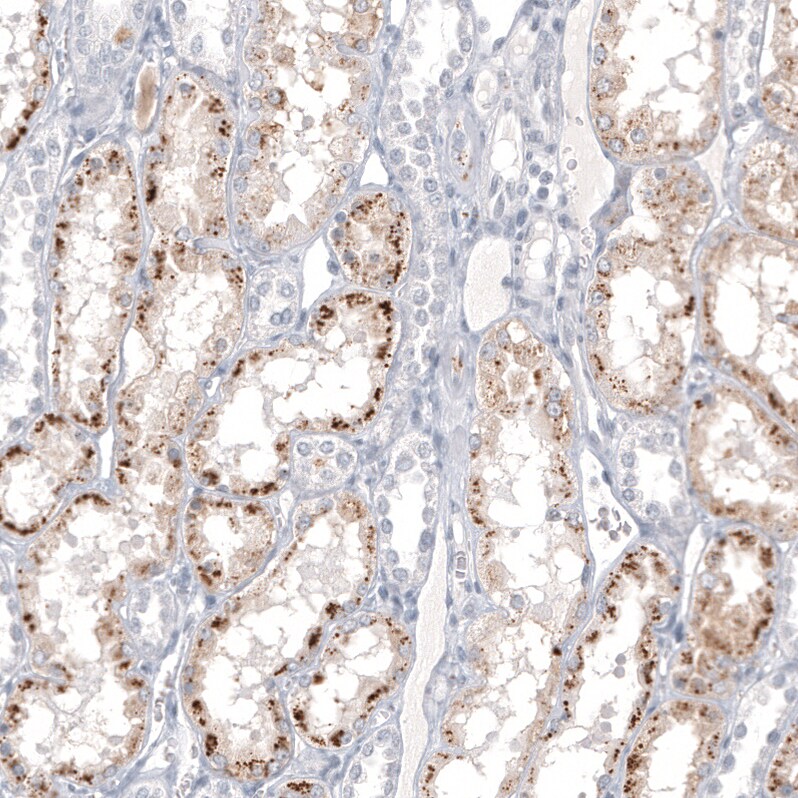Napsin A Antibody (CL12954) - Azide and BSA Free Immunohistochemistry-Paraffin: Napsin A Antibody [NBP3-44369]