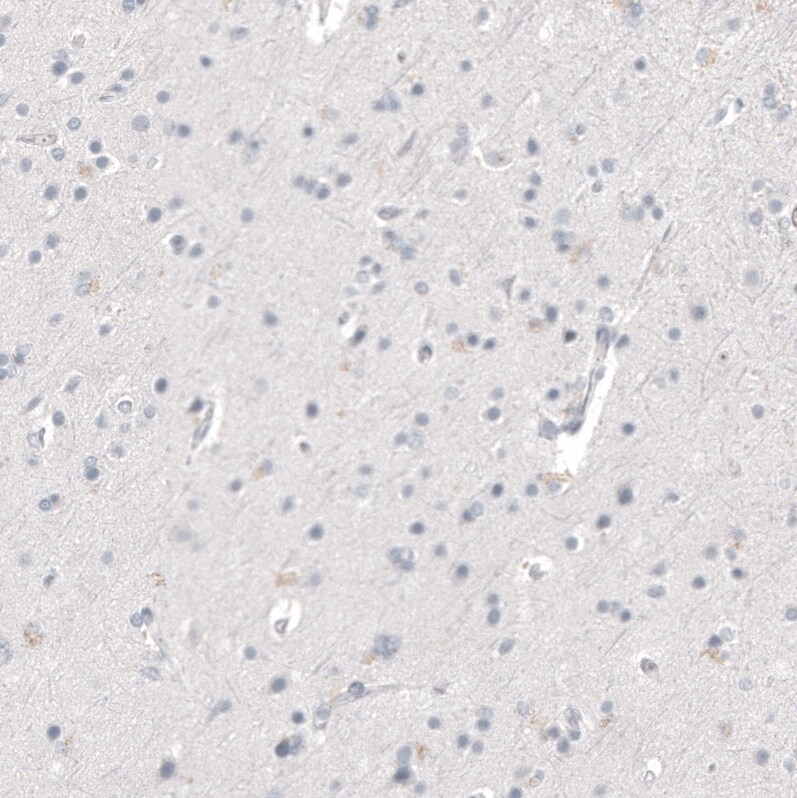 Napsin A Antibody (CL12954) - Azide and BSA Free Immunohistochemistry-Paraffin: Napsin A Antibody [NBP3-44369]