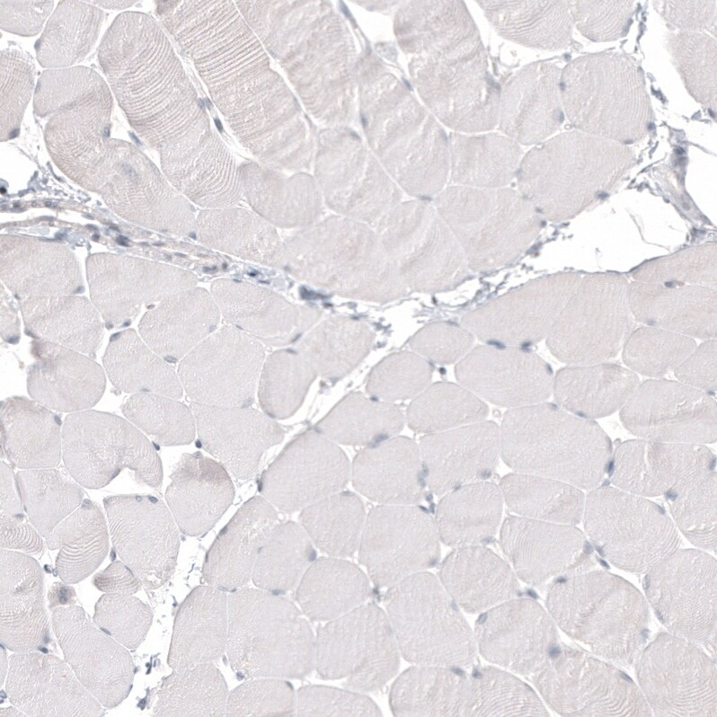 Napsin A Antibody (CL12954) - Azide and BSA Free Immunohistochemistry-Paraffin: Napsin A Antibody [NBP3-44369]