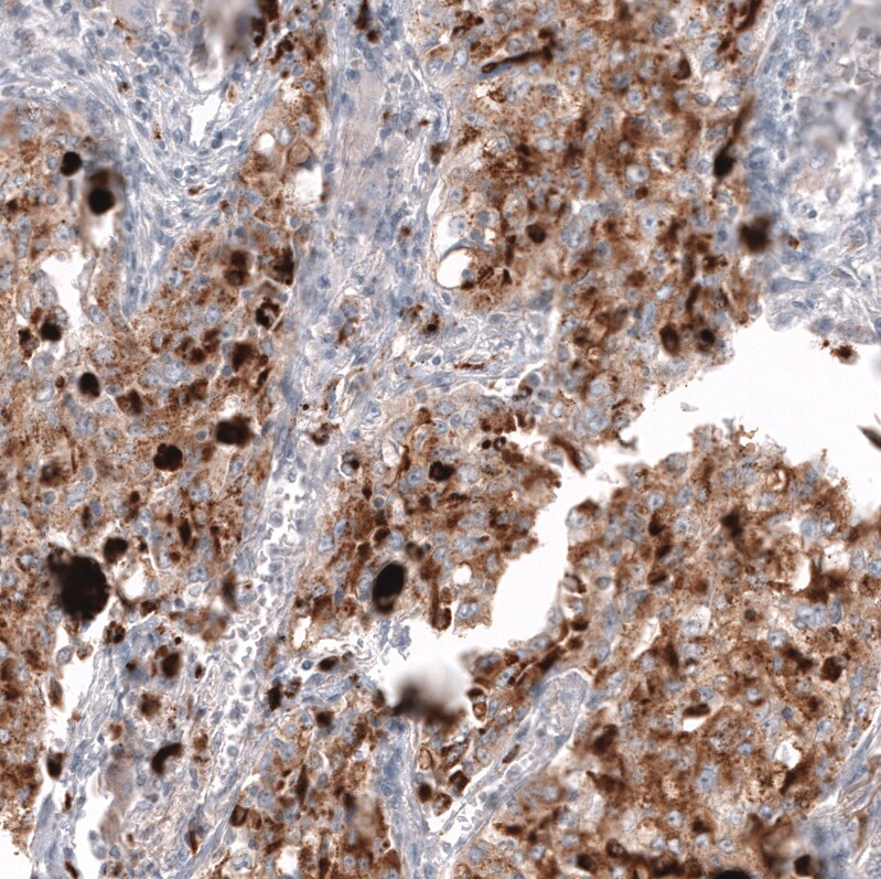 Napsin A Antibody (CL12954) - Azide and BSA Free Immunohistochemistry-Paraffin: Napsin A Antibody [NBP3-44369]