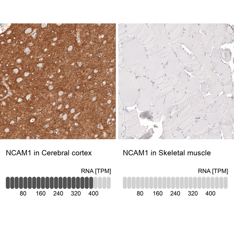 NCAM-1/CD56 Antibody (CL12732) - Azide and BSA Free Immunohistochemistry-Paraffin: NCAM-1/CD56 Antibody [NBP3-44370]