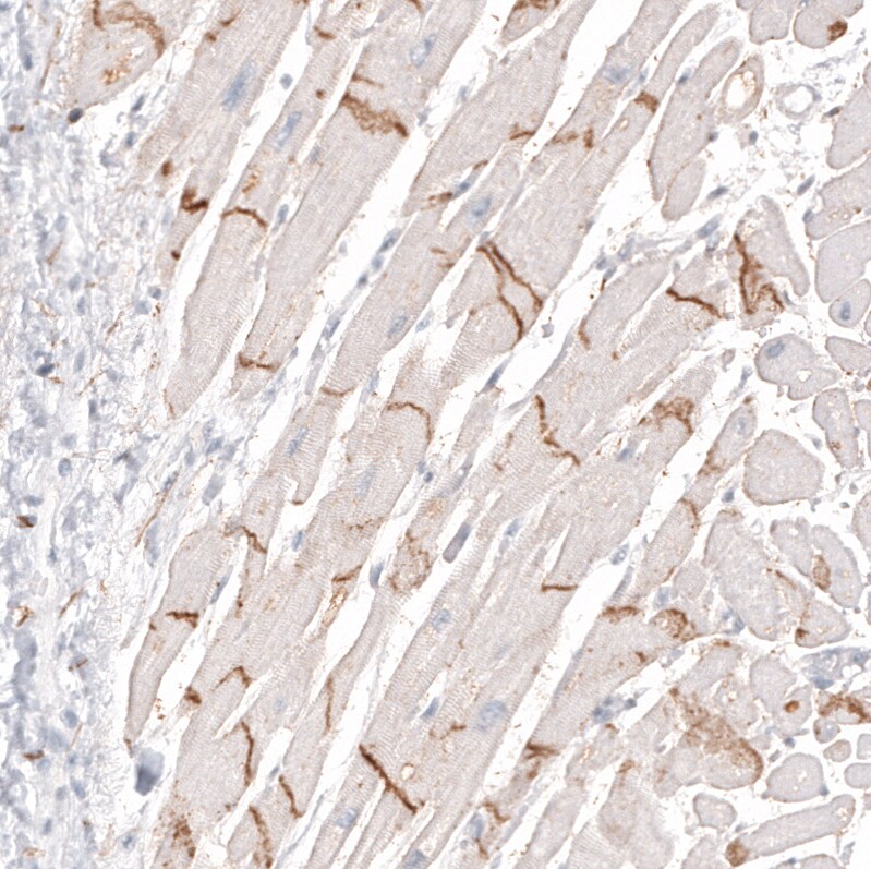 NCAM-1/CD56 Antibody (CL12732) - Azide and BSA Free Immunohistochemistry-Paraffin: NCAM-1/CD56 Antibody [NBP3-44370]