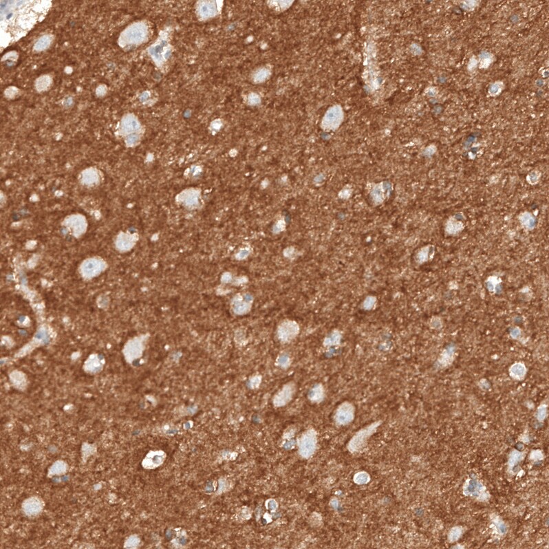 NCAM-1/CD56 Antibody (CL12732) - Azide and BSA Free Immunohistochemistry-Paraffin: NCAM-1/CD56 Antibody [NBP3-44370]