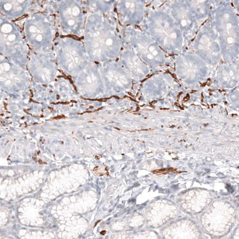 NCAM-1/CD56 Antibody (CL12732) - Azide and BSA Free Immunohistochemistry-Paraffin: NCAM-1/CD56 Antibody [NBP3-44370]