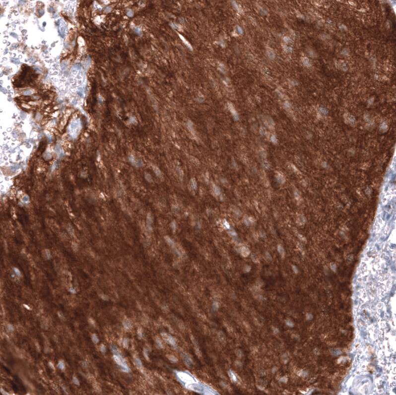 NCAM-1/CD56 Antibody (CL12732) - Azide and BSA Free Immunohistochemistry-Paraffin: NCAM-1/CD56 Antibody [NBP3-44370]