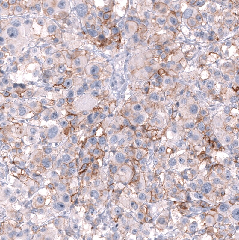 NCAM-1/CD56 Antibody (CL12732) - Azide and BSA Free Immunohistochemistry-Paraffin: NCAM-1/CD56 Antibody [NBP3-44370]