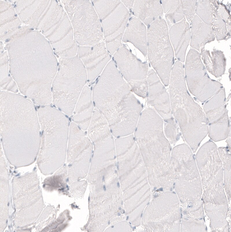 NCAM-1/CD56 Antibody (CL12732) - Azide and BSA Free Immunohistochemistry-Paraffin: NCAM-1/CD56 Antibody [NBP3-44370]