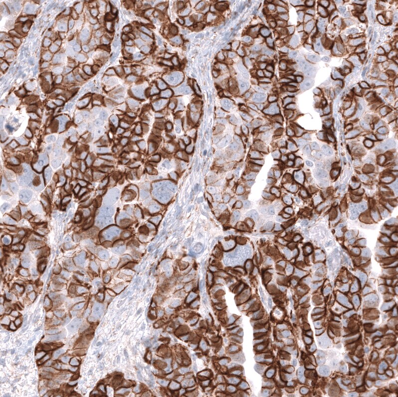 NCAM-1/CD56 Antibody (CL12732) - Azide and BSA Free Immunohistochemistry-Paraffin: NCAM-1/CD56 Antibody [NBP3-44370]