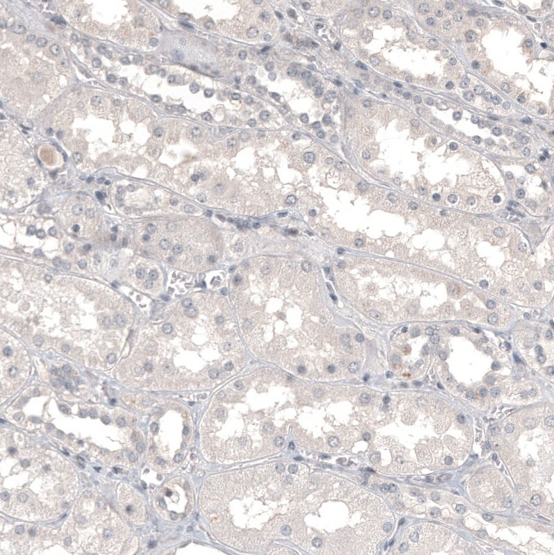CD99 Antibody (CL12929) - Azide and BSA Free Immunohistochemistry-Paraffin: CD99 Antibody [NBP3-44371]