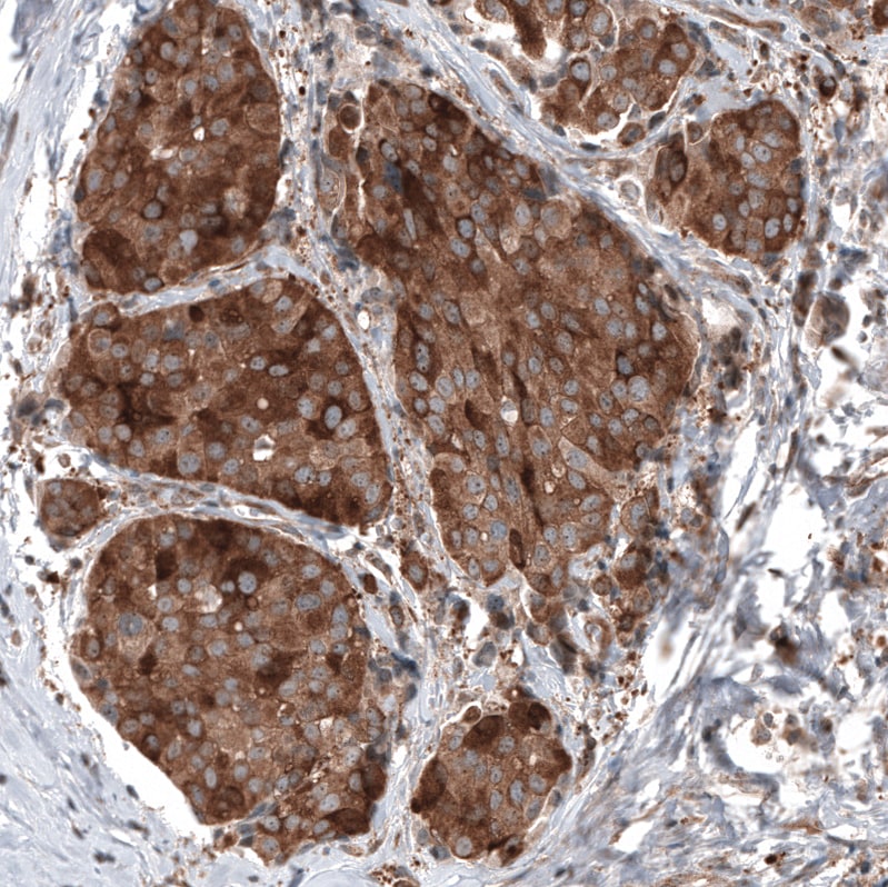 GSPT1 Antibody (CL13336) - Azide and BSA Free Immunohistochemistry-Paraffin: GSPT1 Antibody [NBP3-44372]