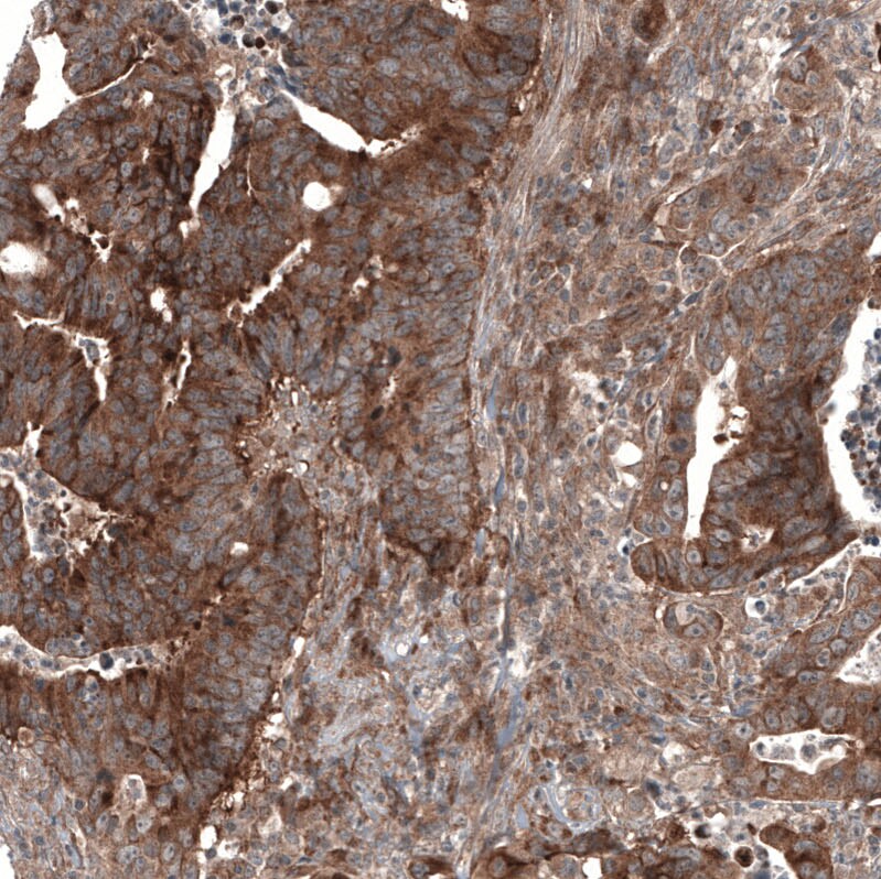 GSPT1 Antibody (CL13336) - Azide and BSA Free Immunohistochemistry-Paraffin: GSPT1 Antibody [NBP3-44372]