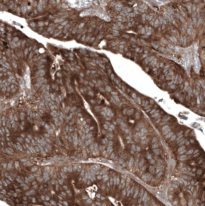 GSPT1 Antibody (CL13336) - Azide and BSA Free Immunohistochemistry-Paraffin: GSPT1 Antibody [NBP3-44372]