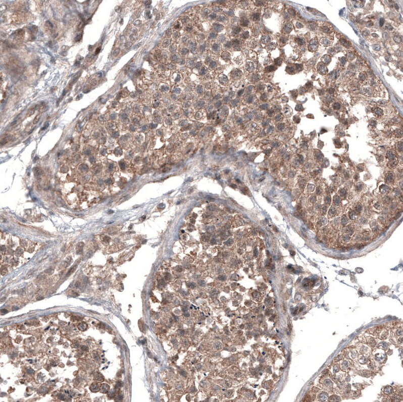 GSPT1 Antibody (CL13336) - Azide and BSA Free Immunohistochemistry-Paraffin: GSPT1 Antibody [NBP3-44372]