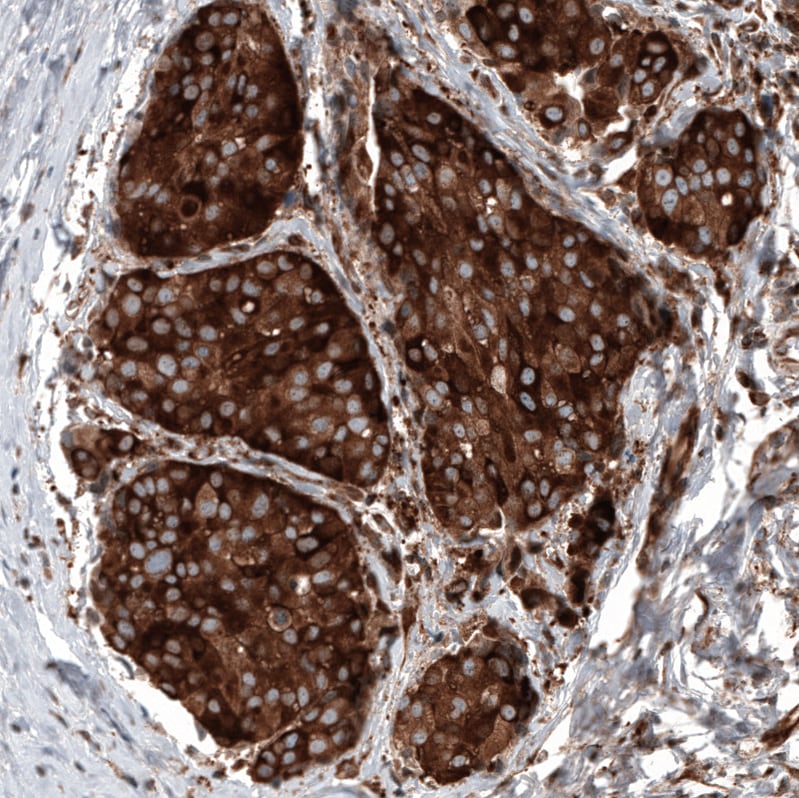 GSPT1 Antibody (CL13332) - Azide and BSA Free Immunohistochemistry-Paraffin: GSPT1 Antibody [NBP3-44373]