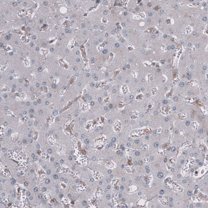GSPT1 Antibody (CL13332) - Azide and BSA Free Immunohistochemistry-Paraffin: GSPT1 Antibody [NBP3-44373]