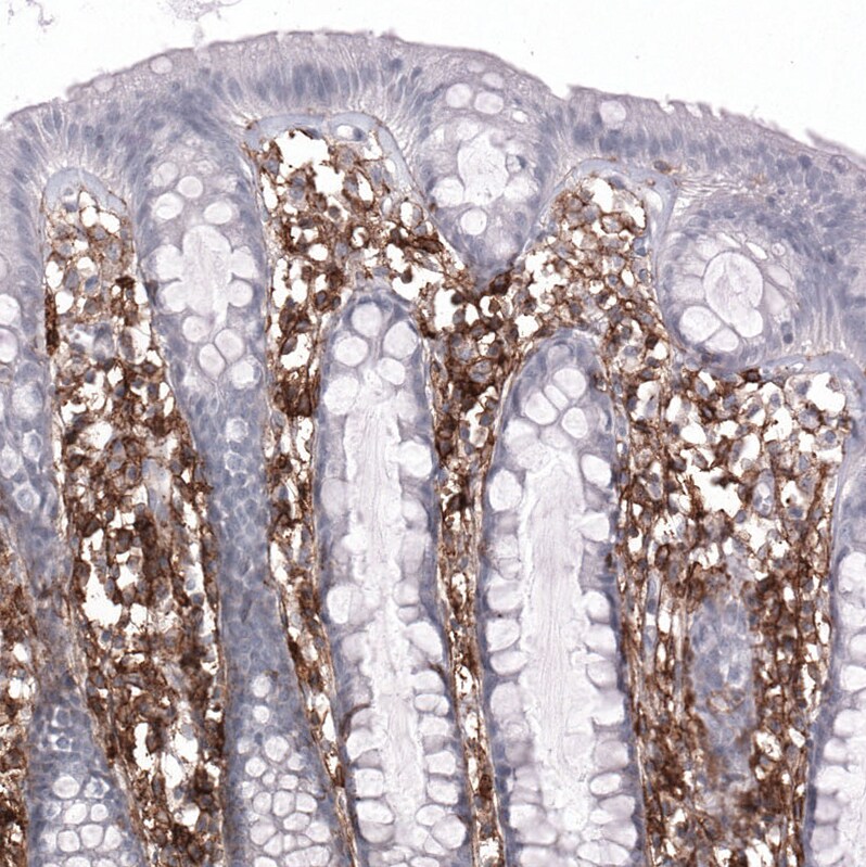 CD44 Antibody (CL13328) - Azide and BSA Free Immunohistochemistry-Paraffin: CD44 Antibody [NBP3-44374]