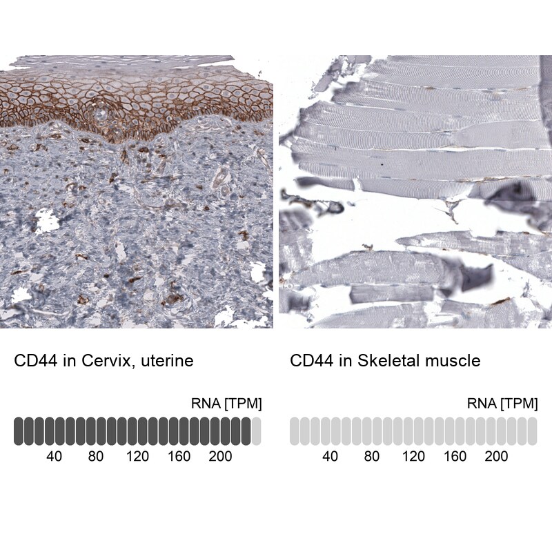 CD44 Antibody (CL13328) - Azide and BSA Free Immunohistochemistry-Paraffin: CD44 Antibody [NBP3-44374]