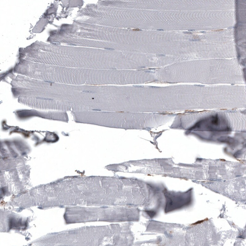 CD44 Antibody (CL13328) - Azide and BSA Free Immunohistochemistry-Paraffin: CD44 Antibody [NBP3-44374]