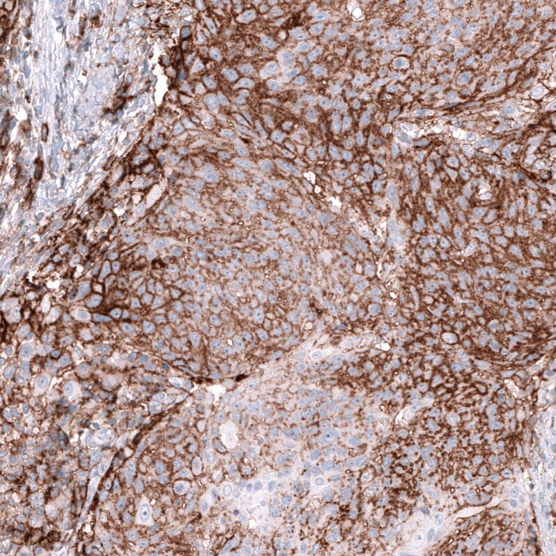 CD44 Antibody (CL13324) - Azide and BSA Free Immunohistochemistry-Paraffin: CD44 Antibody [NBP3-44375]