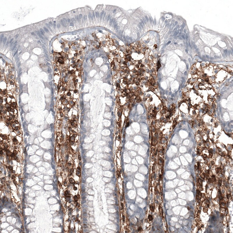 CD44 Antibody (CL13324) - Azide and BSA Free Immunohistochemistry-Paraffin: CD44 Antibody [NBP3-44375]
