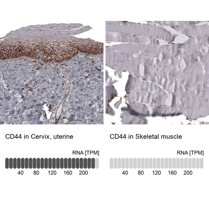 CD44 Antibody (CL13324) - Azide and BSA Free Immunohistochemistry-Paraffin: CD44 Antibody [NBP3-44375]