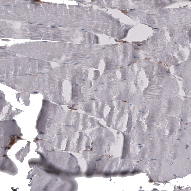 CD44 Antibody (CL13324) - Azide and BSA Free Immunohistochemistry-Paraffin: CD44 Antibody [NBP3-44375]